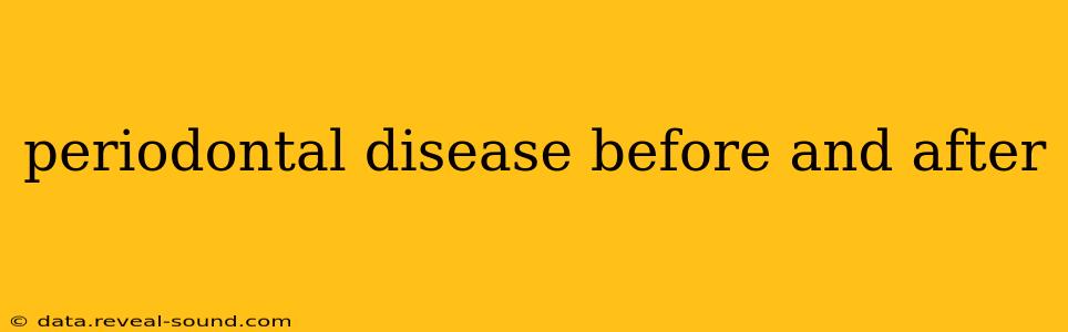 periodontal disease before and after