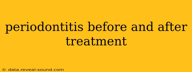 periodontitis before and after treatment
