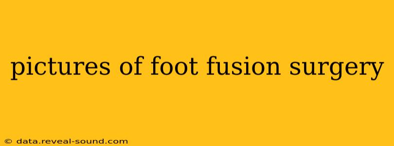 pictures of foot fusion surgery