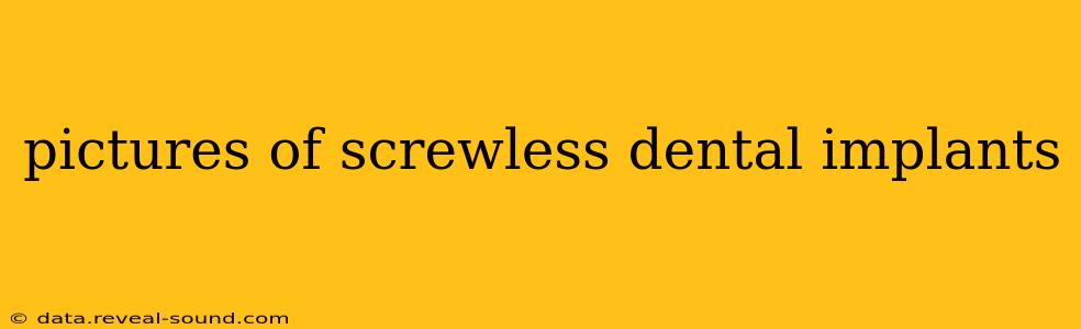 pictures of screwless dental implants