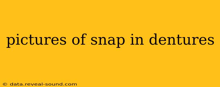 pictures of snap in dentures