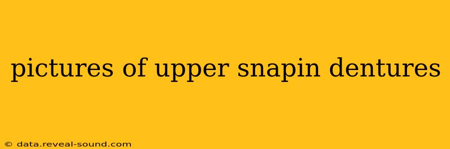 pictures of upper snapin dentures