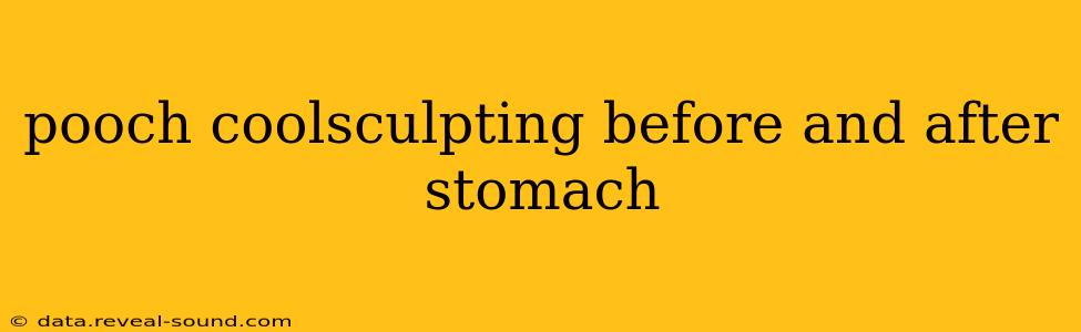 pooch coolsculpting before and after stomach