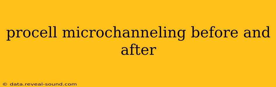 procell microchanneling before and after