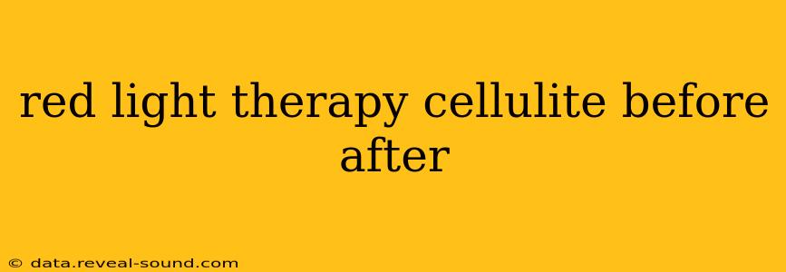 red light therapy cellulite before after