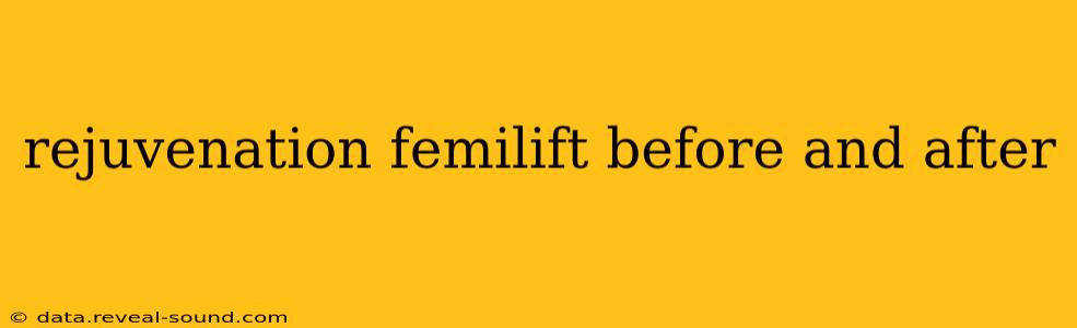 rejuvenation femilift before and after
