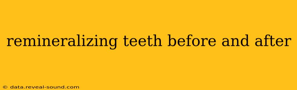 remineralizing teeth before and after