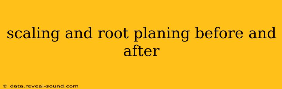 scaling and root planing before and after