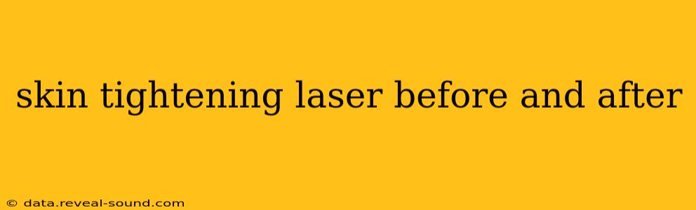 skin tightening laser before and after