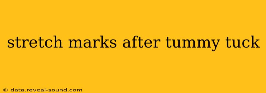 stretch marks after tummy tuck