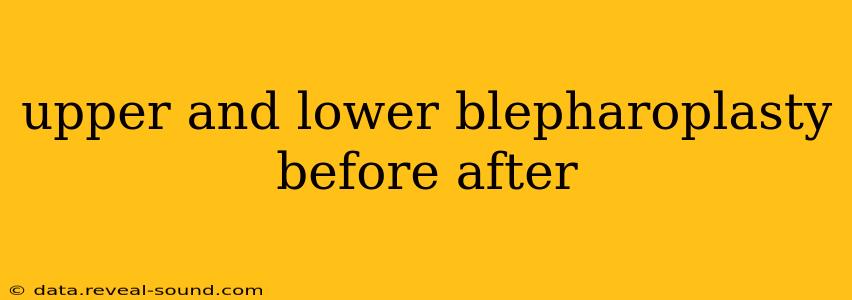 upper and lower blepharoplasty before after
