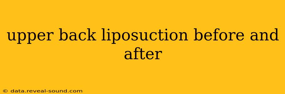 upper back liposuction before and after