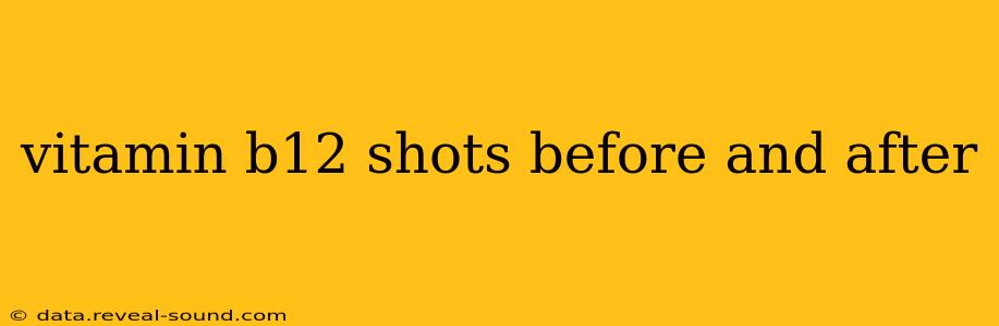 vitamin b12 shots before and after