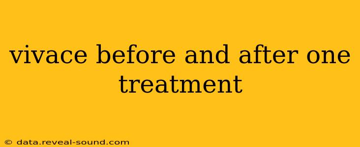 vivace before and after one treatment