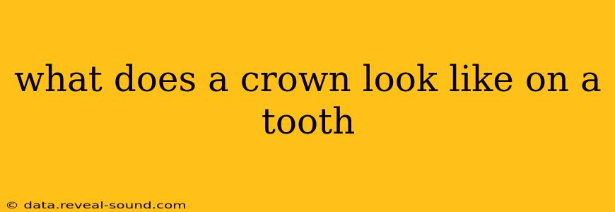 what does a crown look like on a tooth