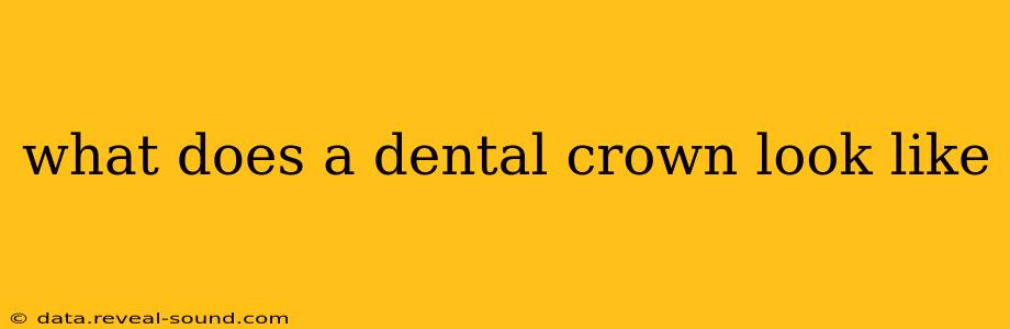 what does a dental crown look like