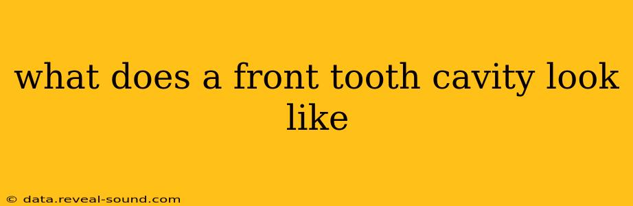what does a front tooth cavity look like