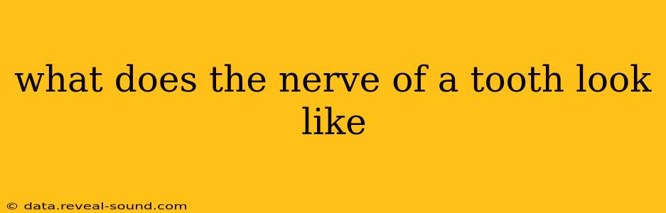 what does the nerve of a tooth look like