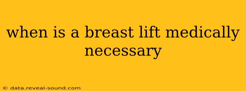 when is a breast lift medically necessary