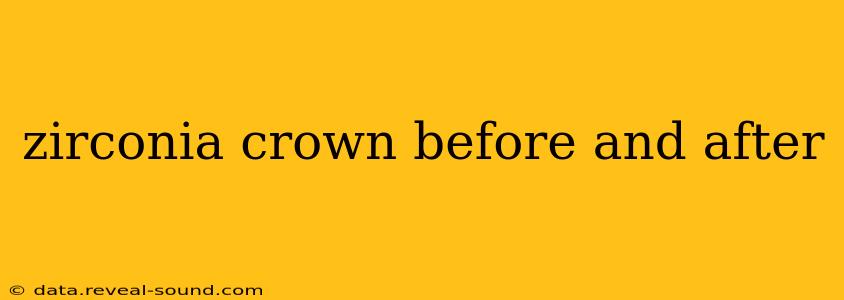 zirconia crown before and after